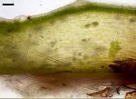 Coupe de thalle d'hépatique (Marchantiophyta)Source wikipédia